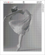 КДИ-0980 Набір алмазної вишивки Балерина-3